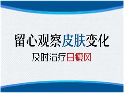 预防白癜风需要做好以下3点